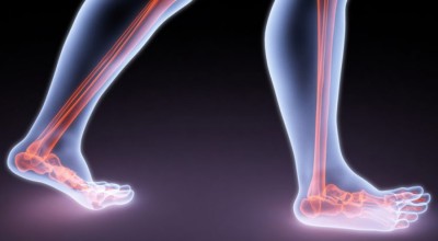 Ayak Uyuşmasının Nedenleri Ayak Uyuşmasının Nedenleri